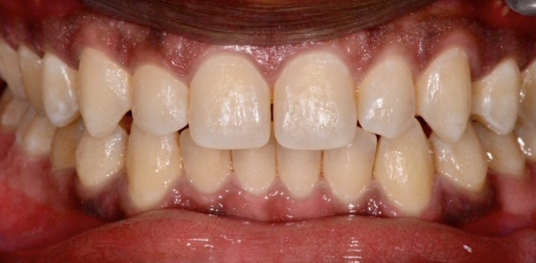 Before Image