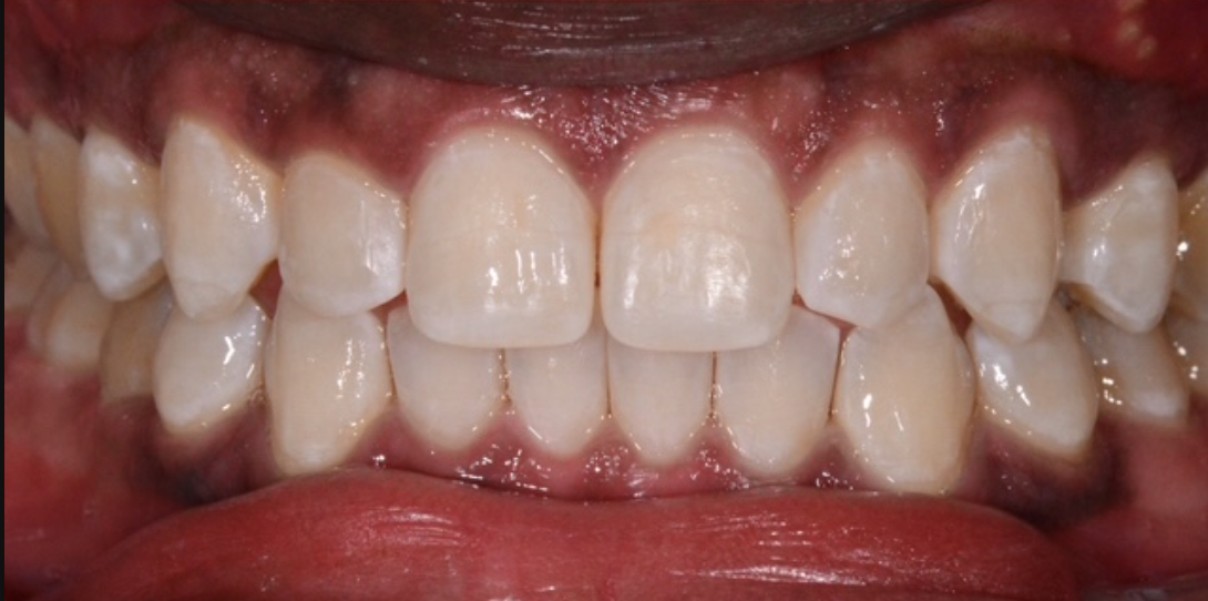 After Image