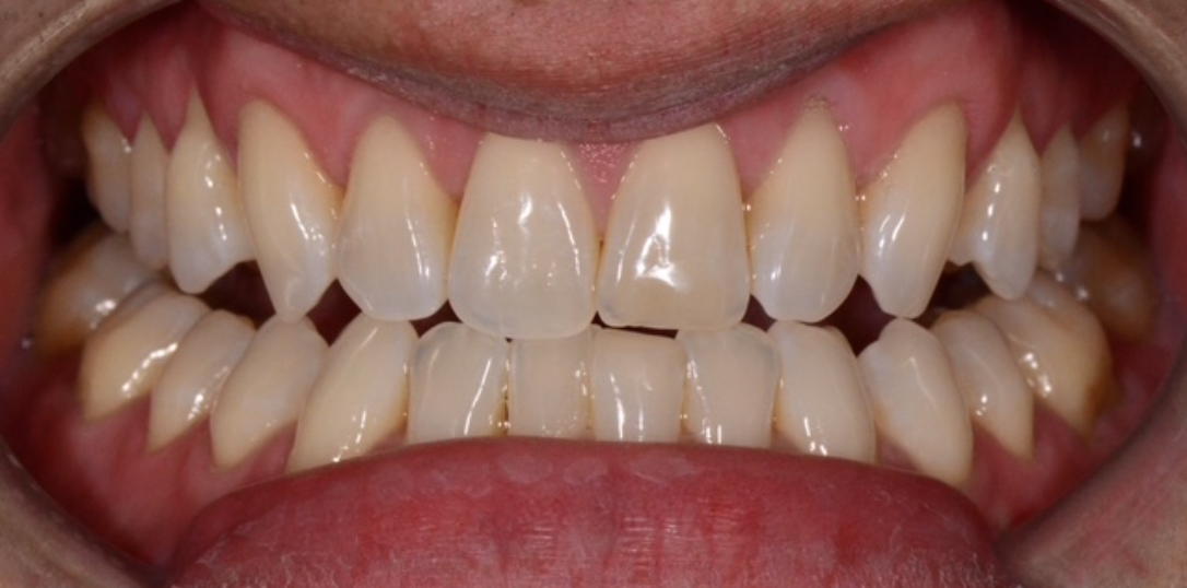 Before Image