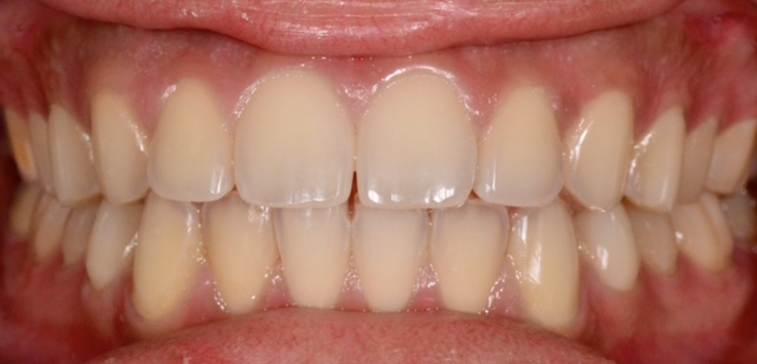 Before Image