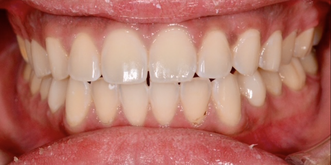 After Image