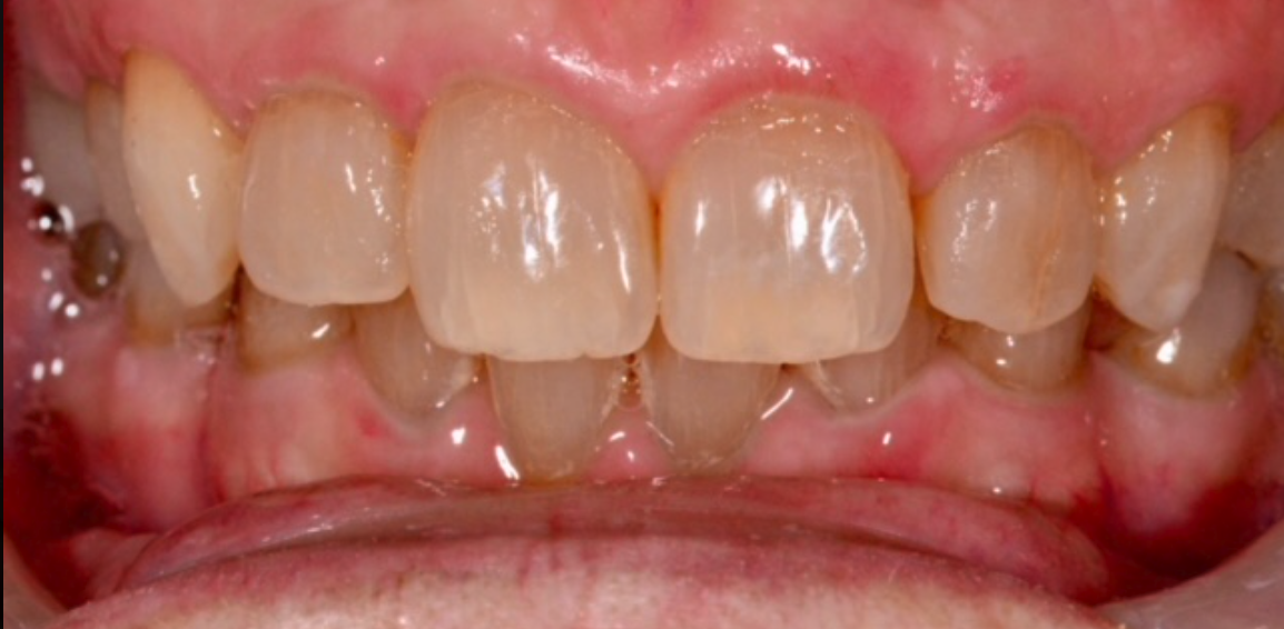 Before Image