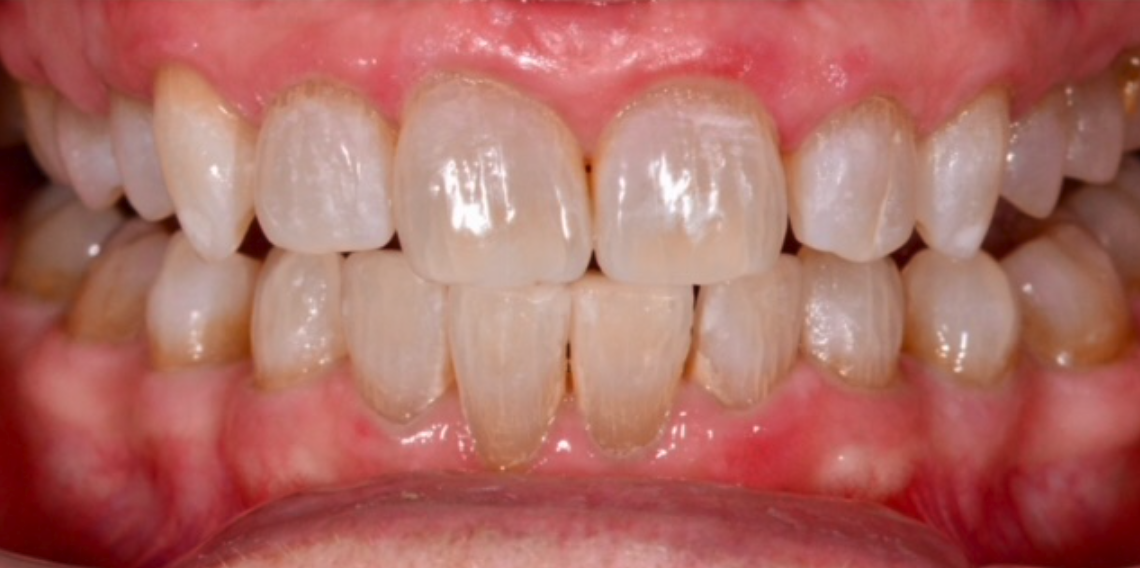 After Image