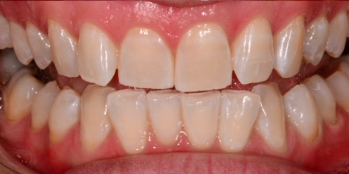 After Image