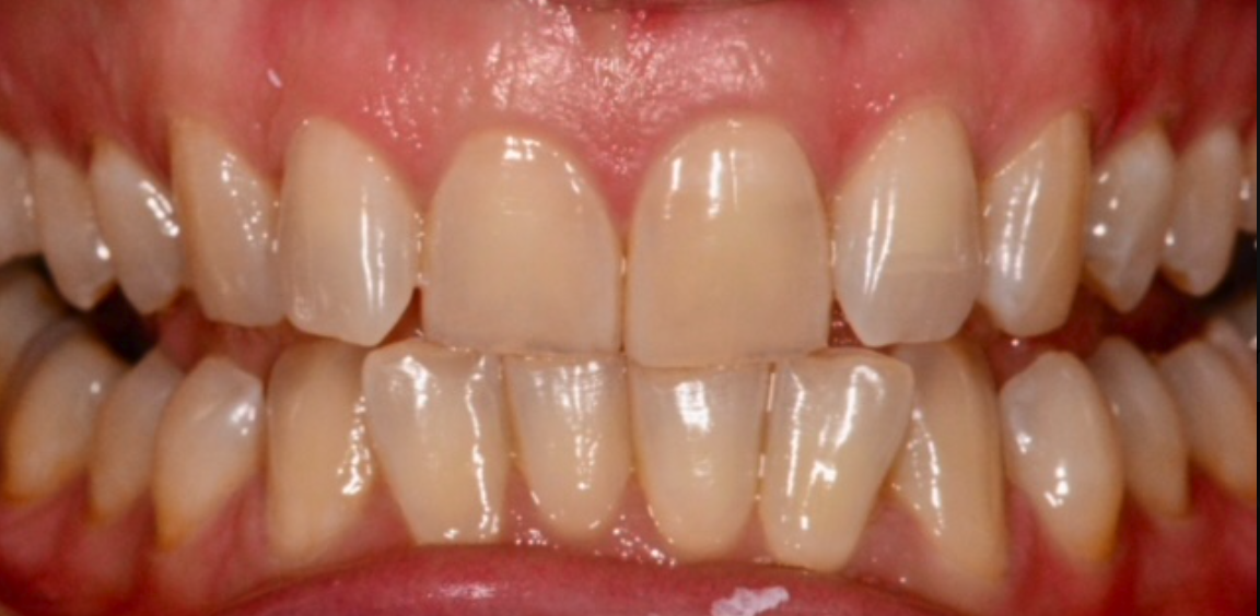 Before Image