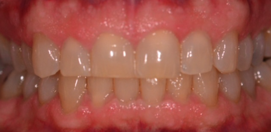 Before Image