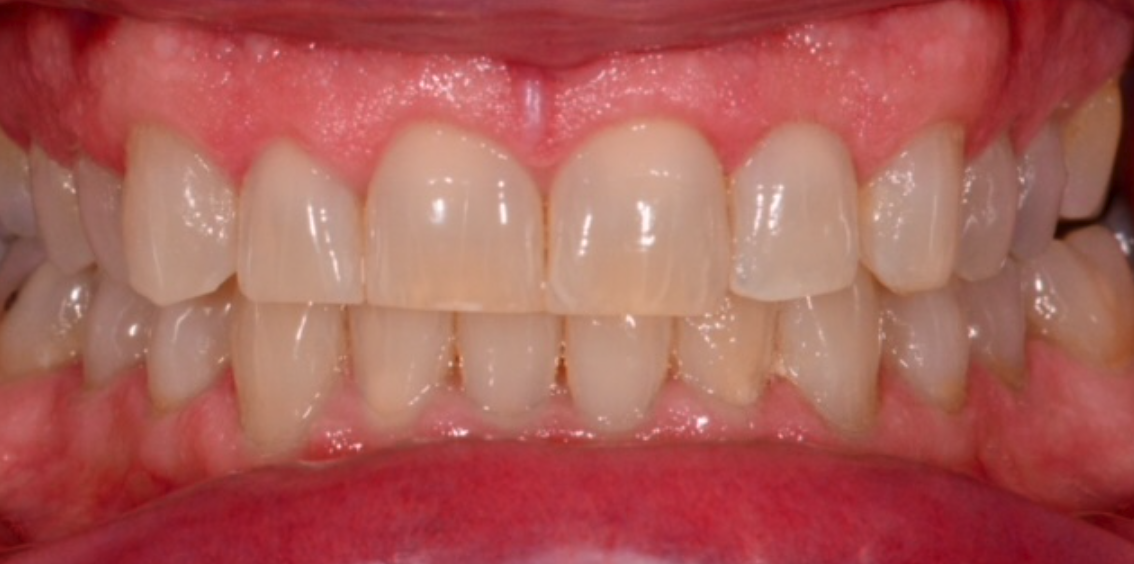 After Image