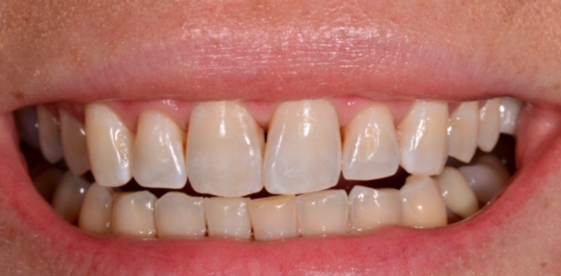 Before Image