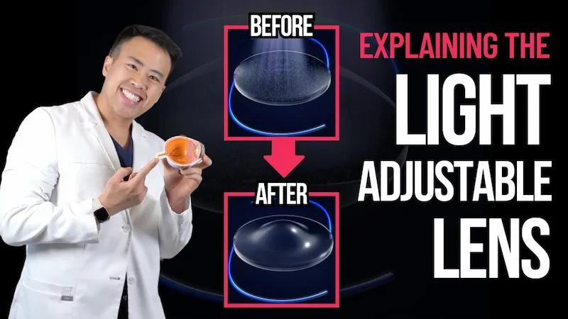 Dr. Jeffrey Tran explaining the Light Adjustable Lens for cataract surgery — patient education video from Stratus Eye in Suwanee, GA