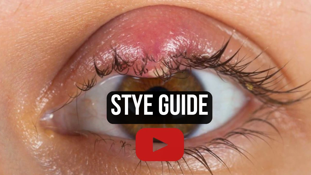Dr. Jeffrey Tran explaining stye and dry eye connection — patient education video from Stratus Eye in Suwanee, GA