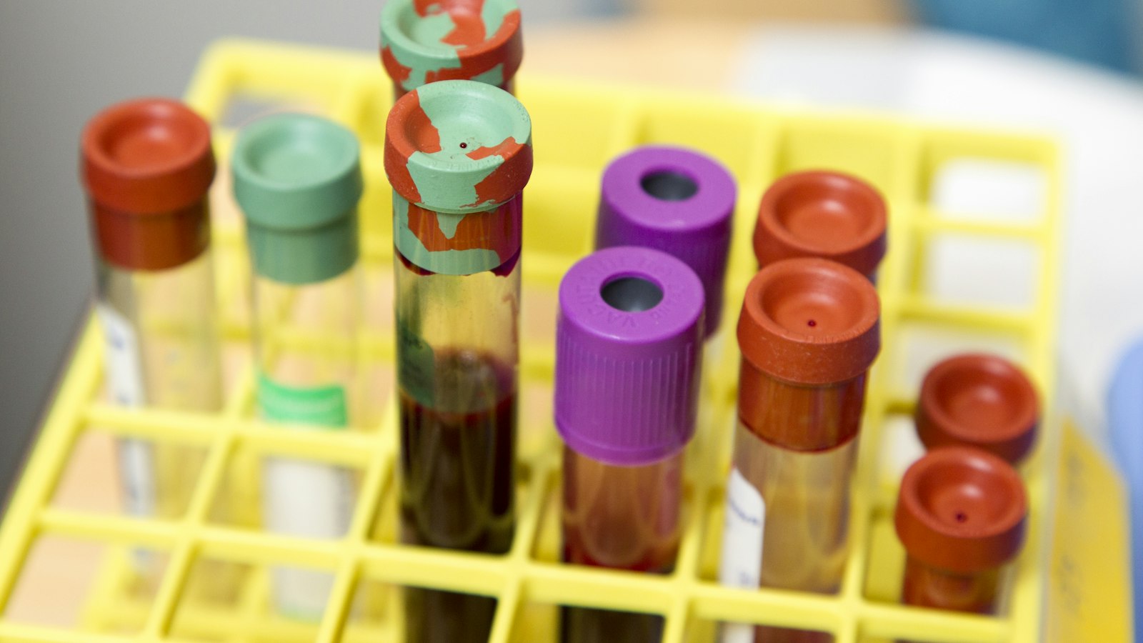 Blood test tubes in a rack
