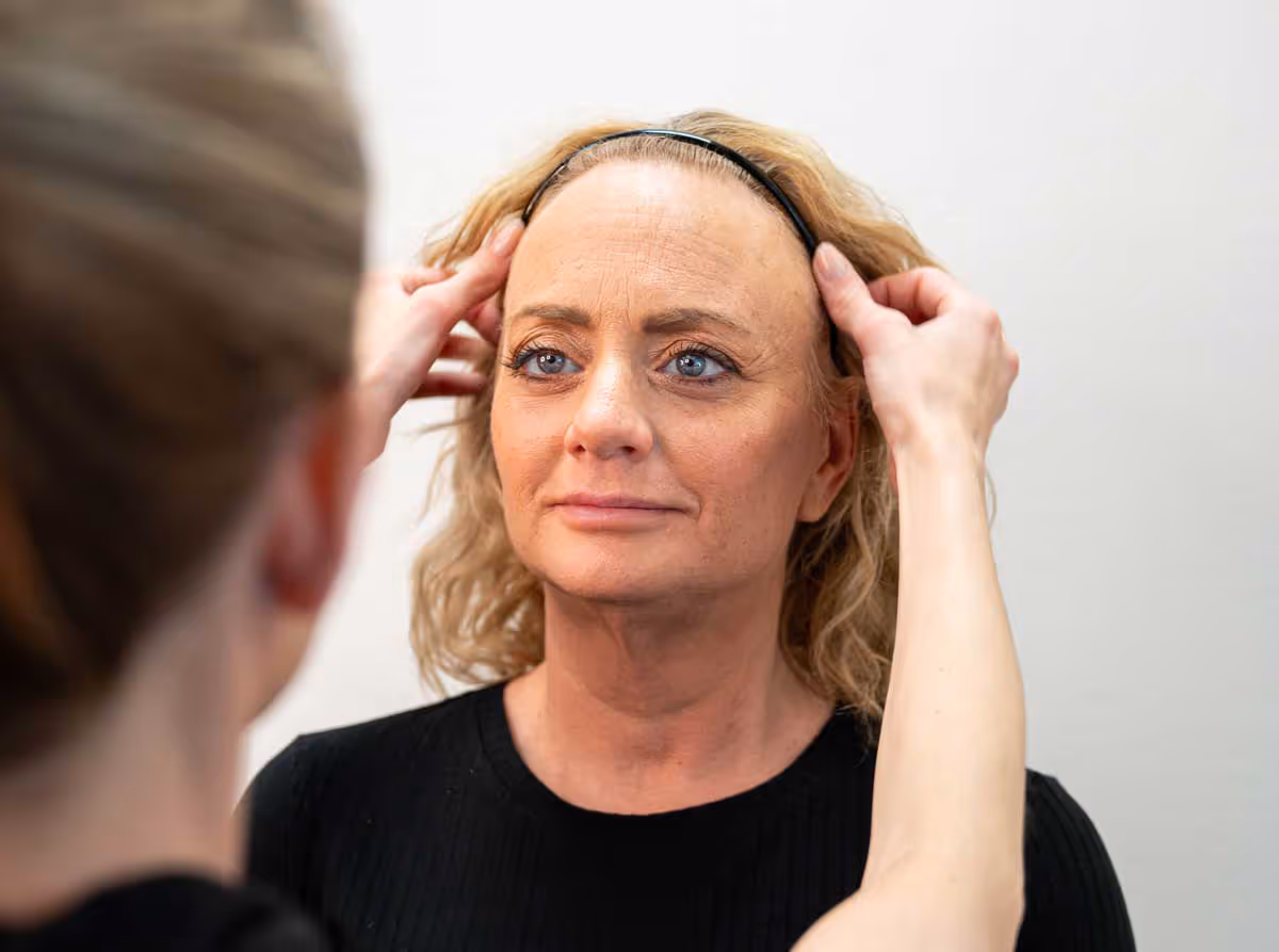 En kvinna får en konsultation inför hårtransplantation