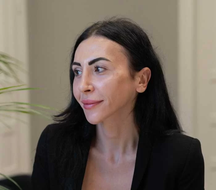 En kvinna med sin nya hårlinje