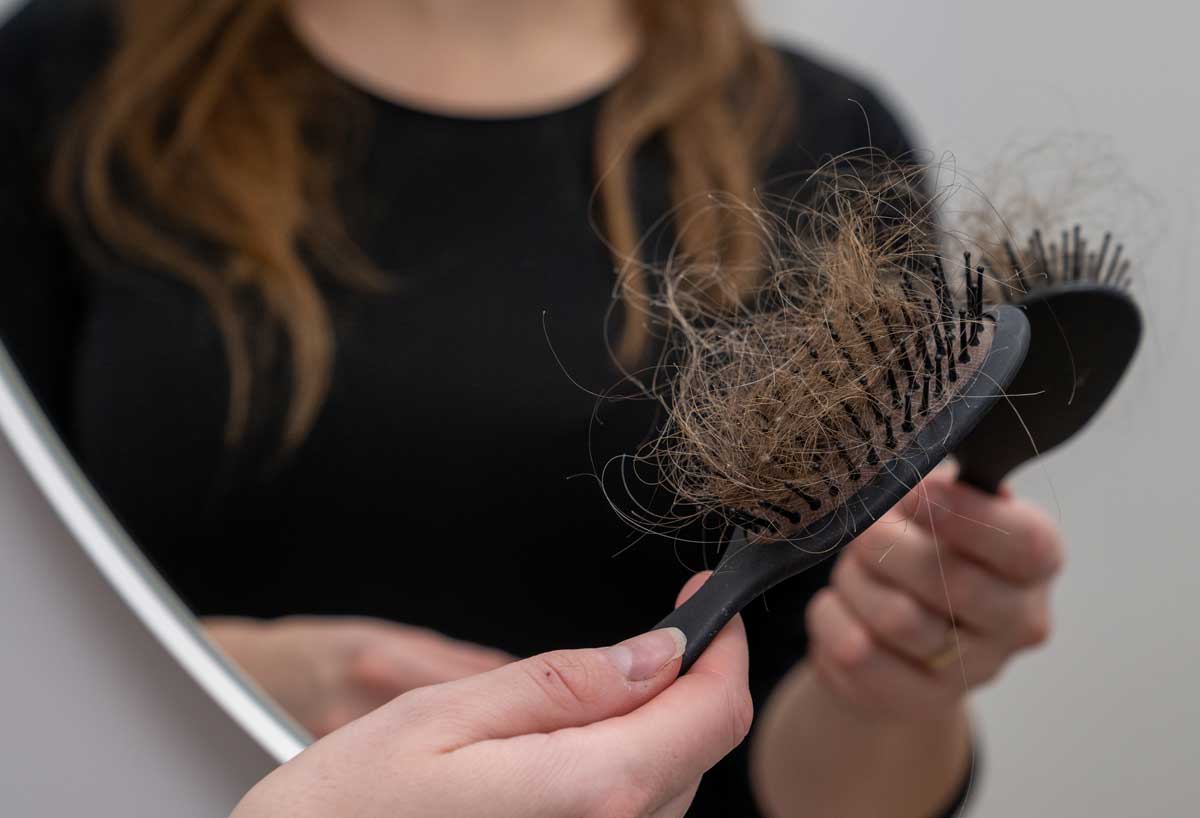 En ung kvinna undersöker sitt hår efter håravfall