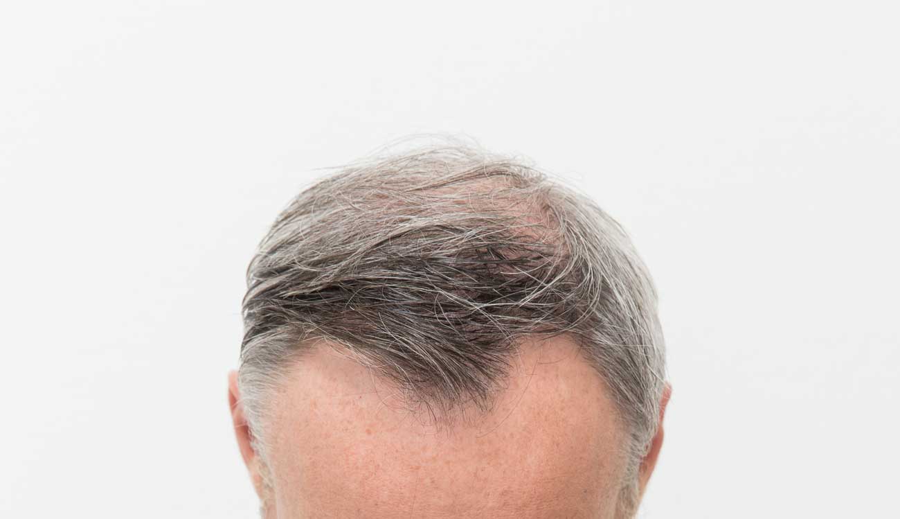 En man med höga vikar