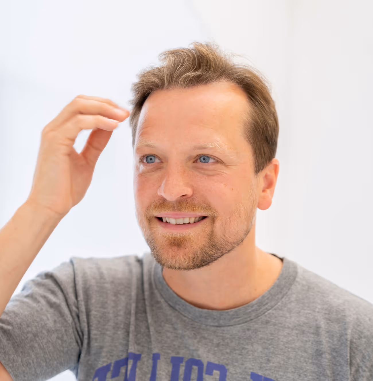 En man som testar Minoxidil