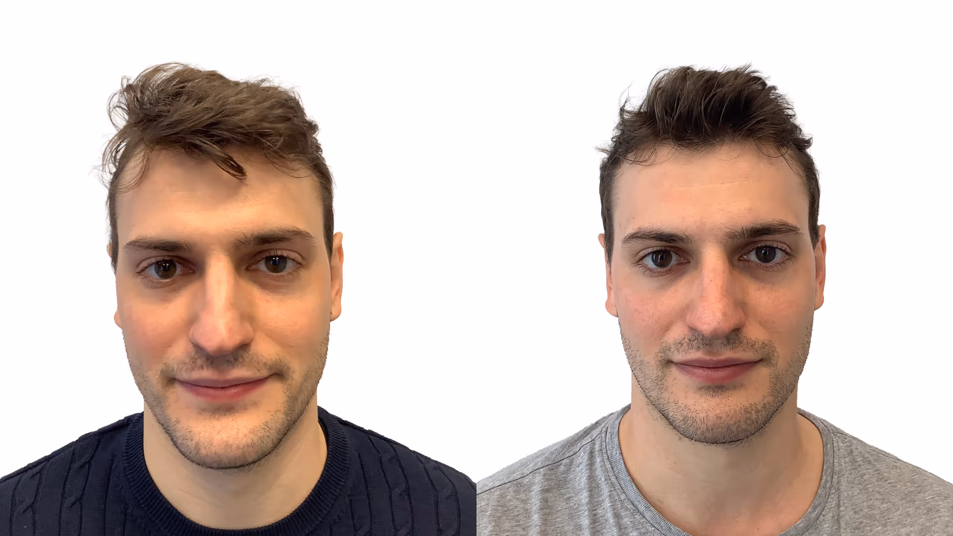 Valentin – före och efter sin hårbehandling