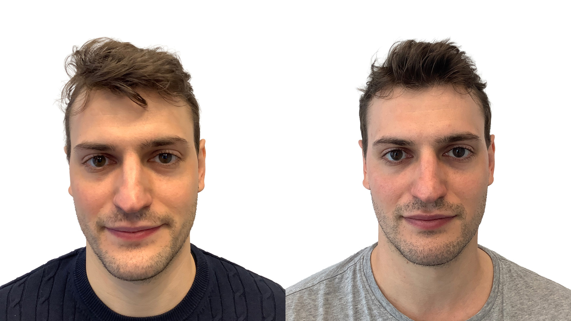 Valentin – före och efter sin hårbehandling