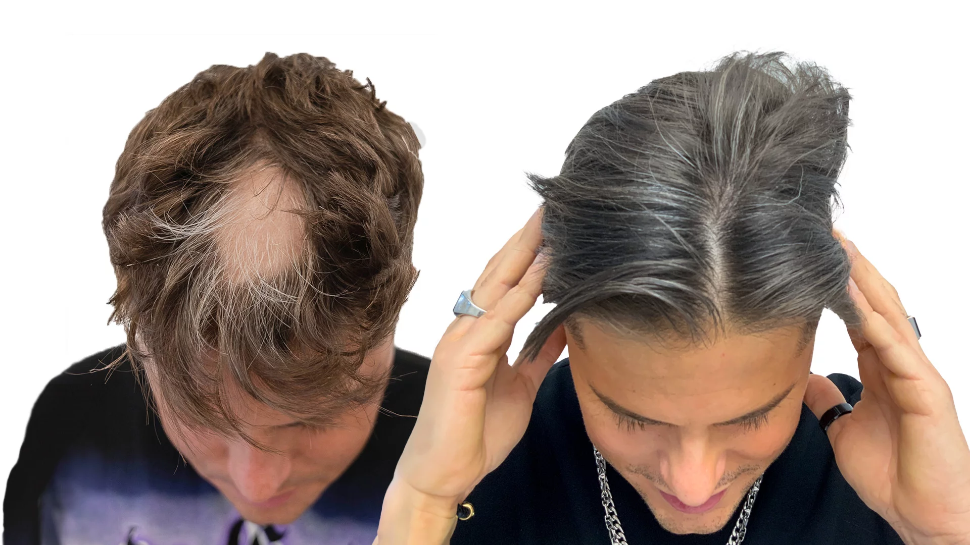 Oliver – före och efter sin hårbehandling