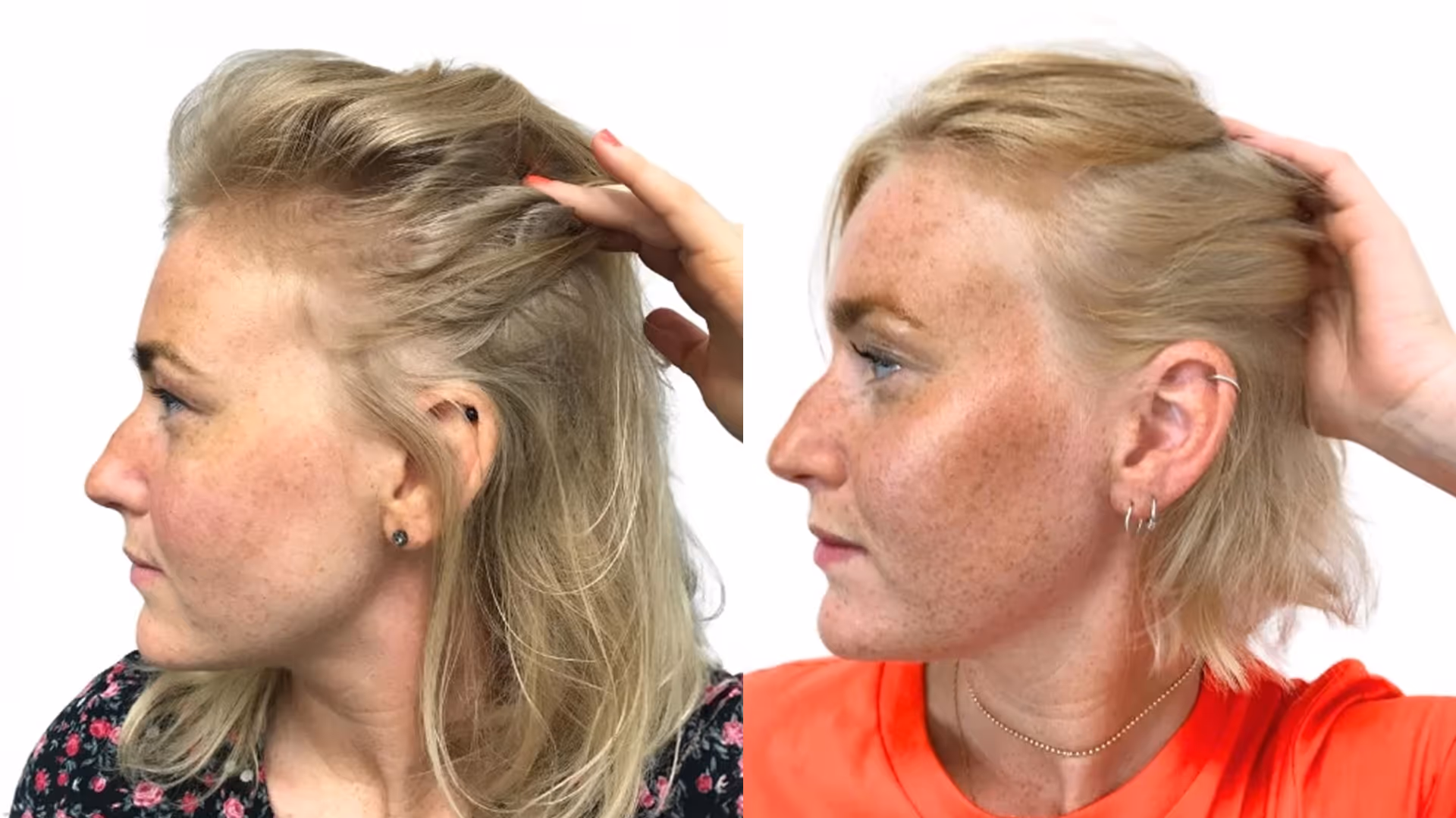 Jonna – före och efter sin hårbehandling