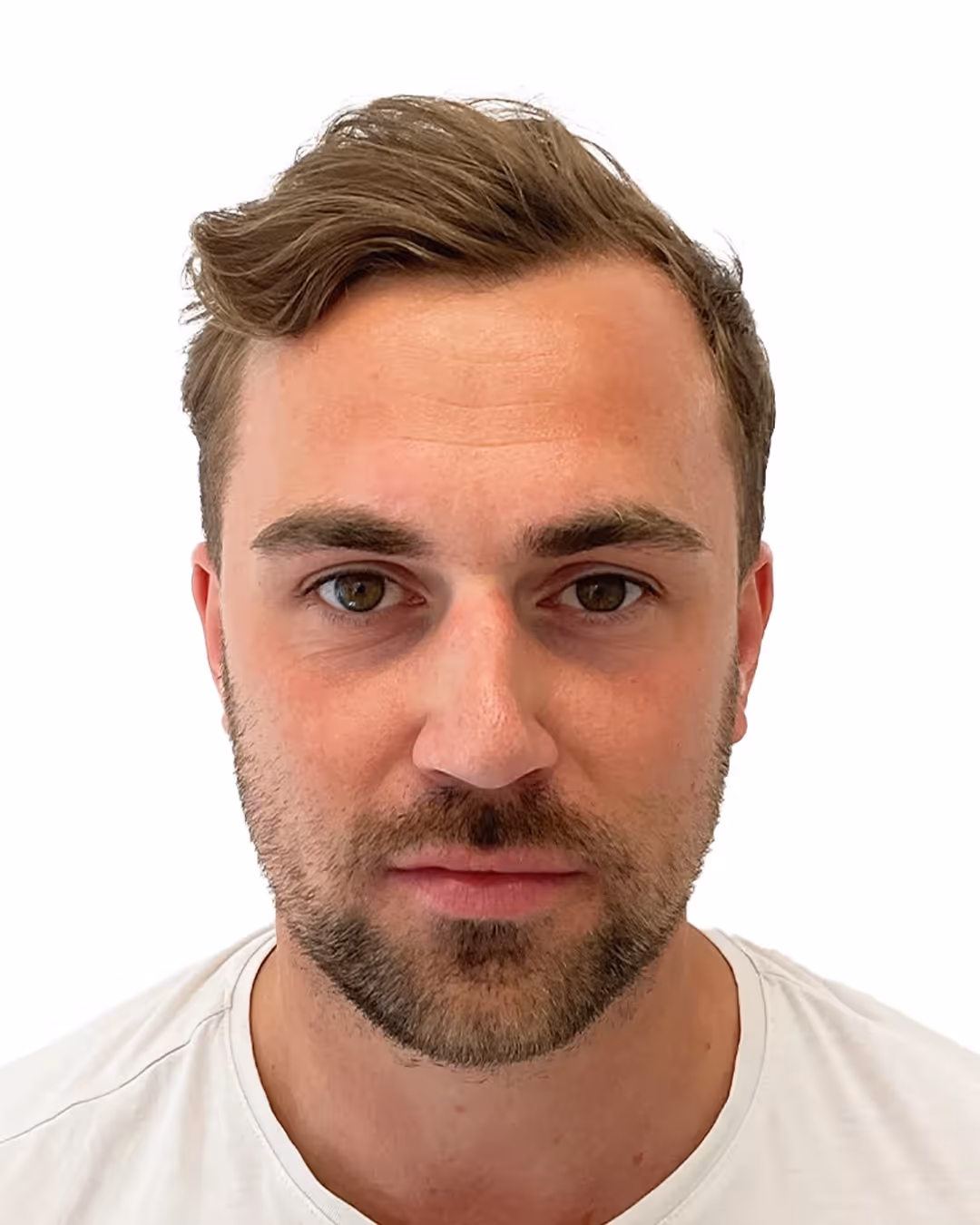 Joakim efter hårbehandlingen