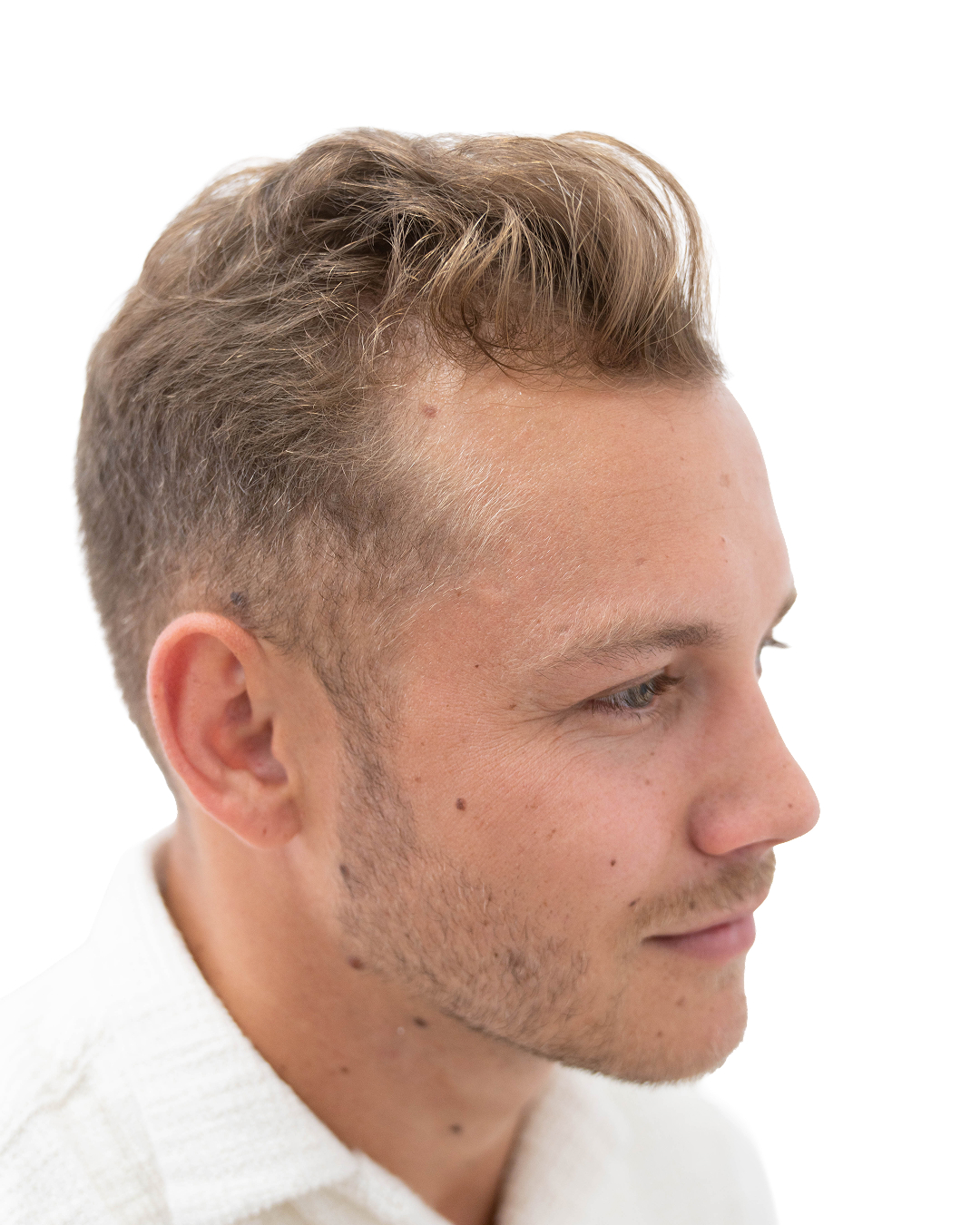 Jesper efter hårbehandlingen