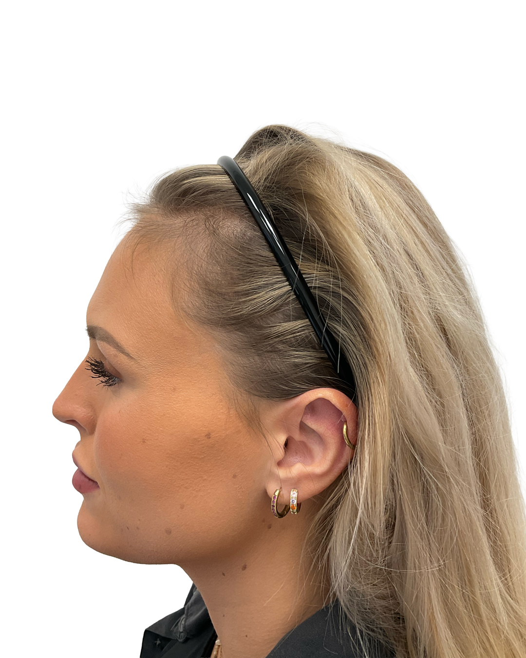 Emilia före hårbehandlingen