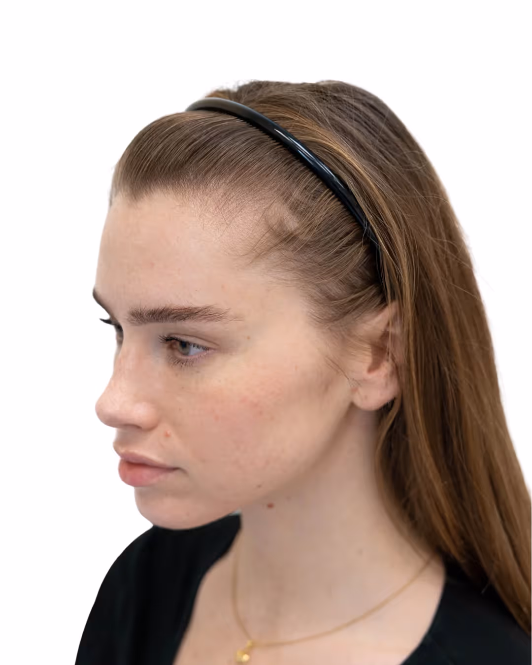 Emilia före hårbehandlingen