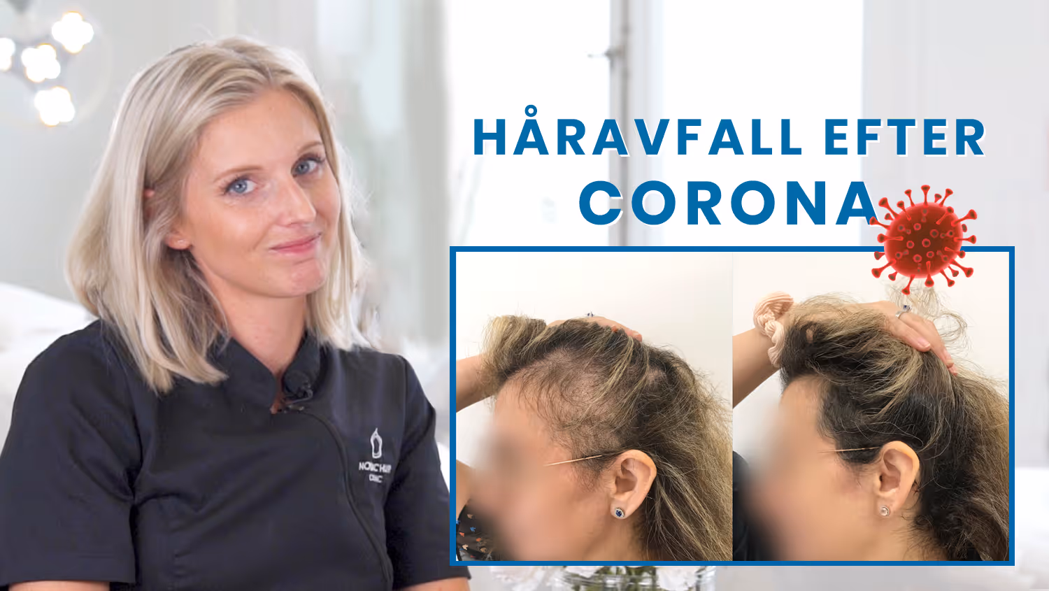 to lose hair from covid 19