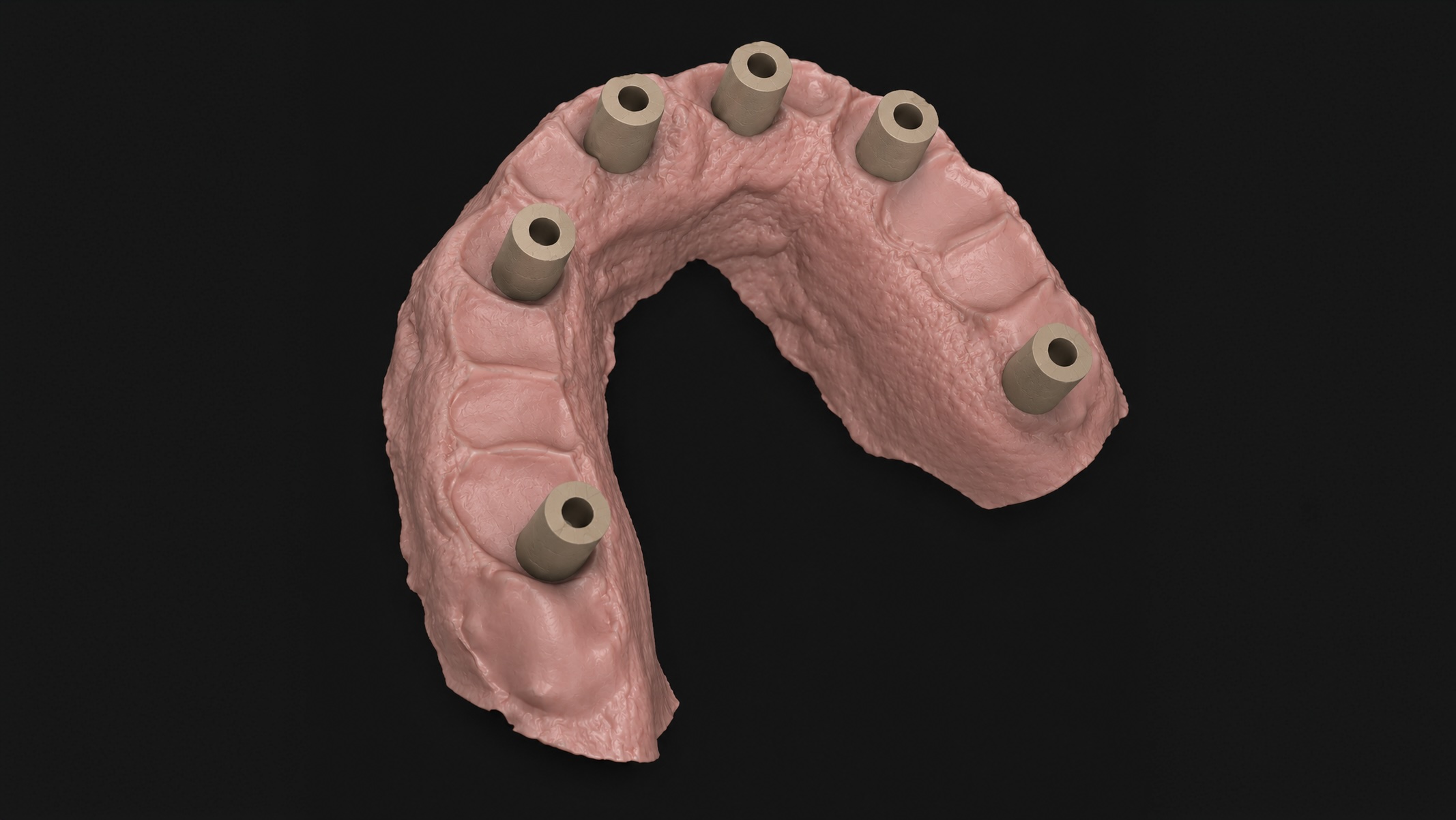 Prosthetics