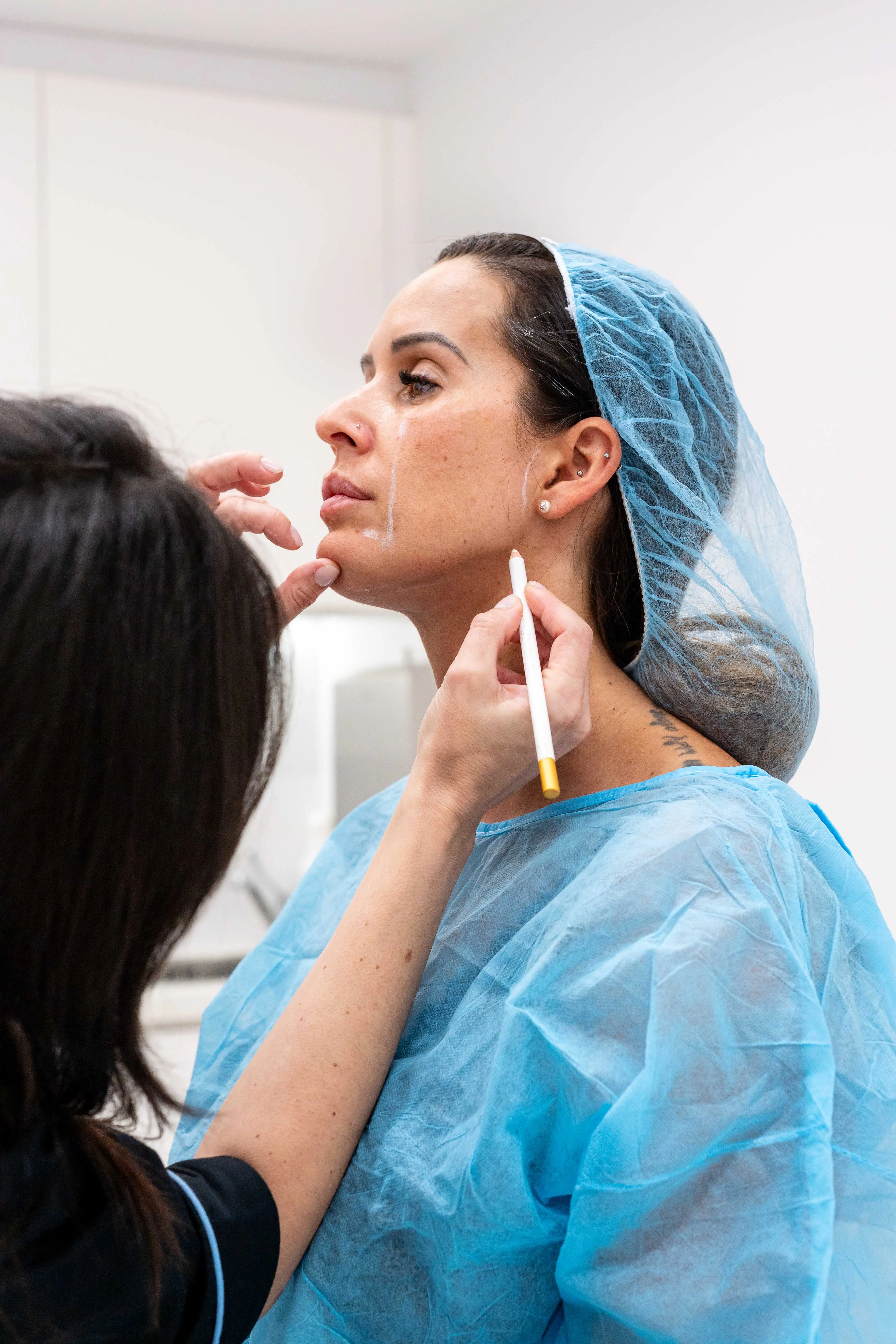 Avaliação clínica facial para harmonização orofacial, com marcação de pontos anatómicos para planeamento preciso e personalizado do tratamento.