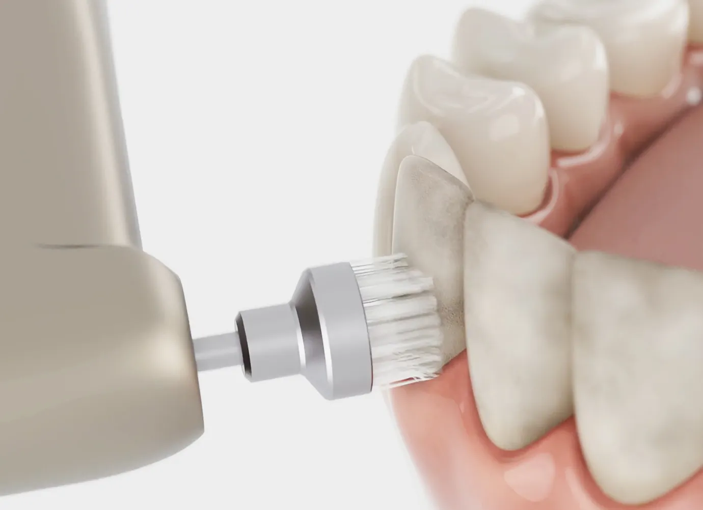 A close-up illustration of a dental handpiece with a polishing brush cleaning the surface of a tooth during a professional dental cleaning to remove plaque and smooth the enamel.