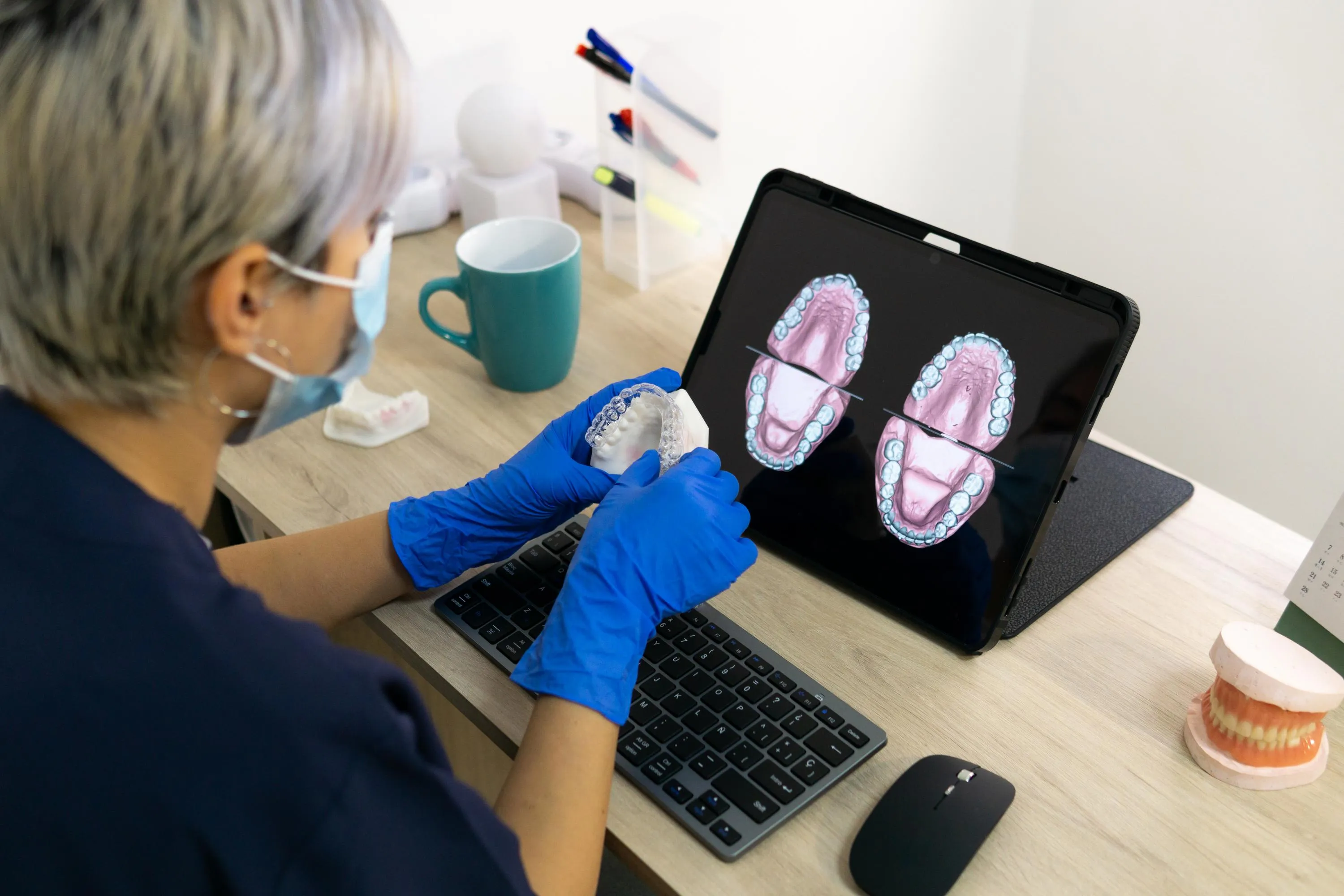 A clinician in gloves examines a 3-D digital model of a patientβs upper and lower bite on a laptop screen while holding a dental cast to compare anatomical details.