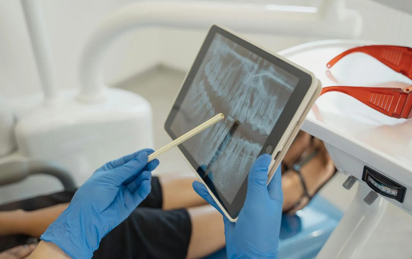 A dentist wearing blue gloves uses a stylus to point at a digital dental X-ray displayed on a tablet, showing the patient’s full mouth radiograph while the patient sits in the dental chair.
