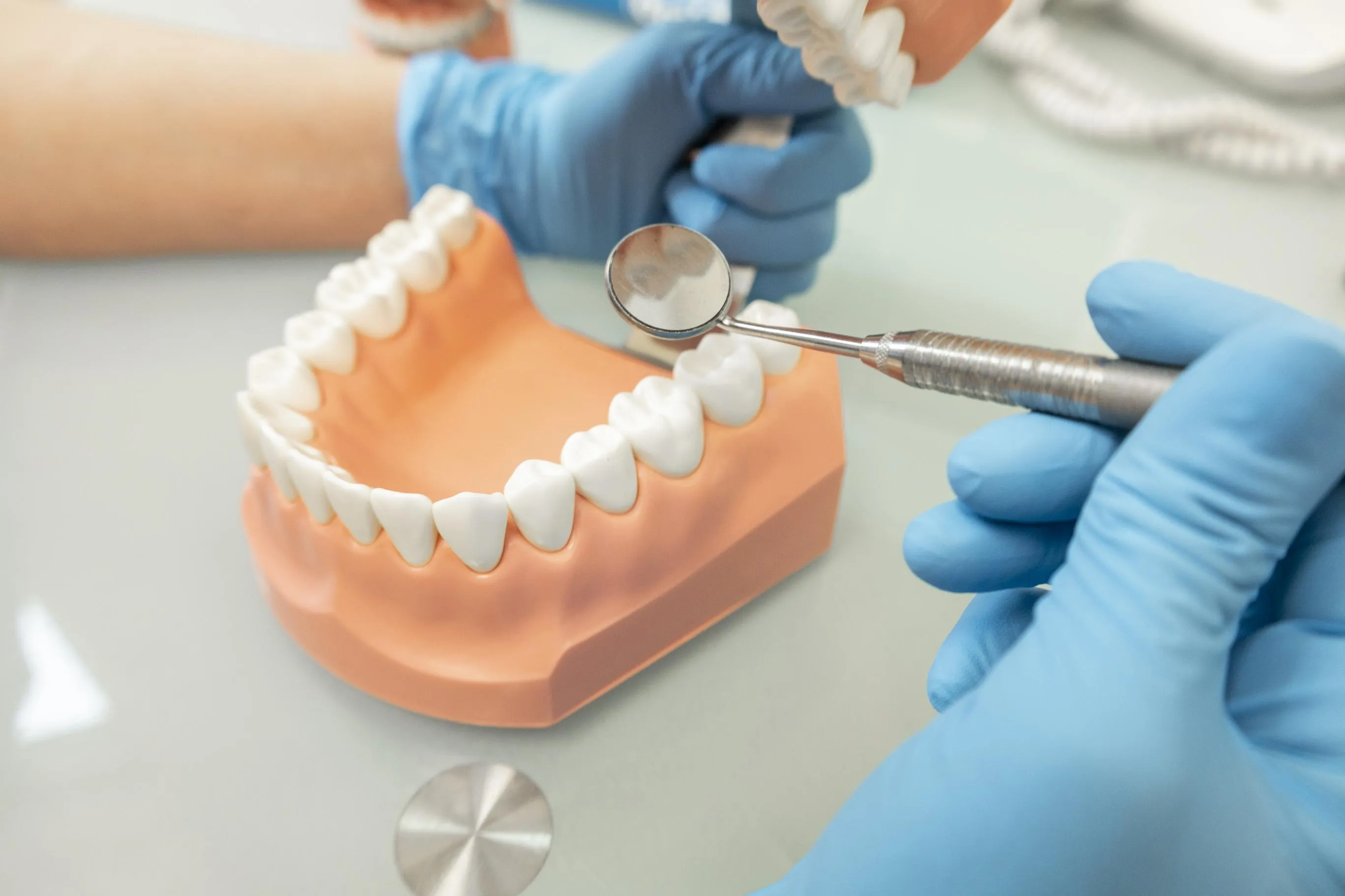 A dental professional wearing blue gloves examines a full dental arch model with an explorer tool, showing multiple ceramic dental crowns seated on the teeth to restore shape, strength, and function.