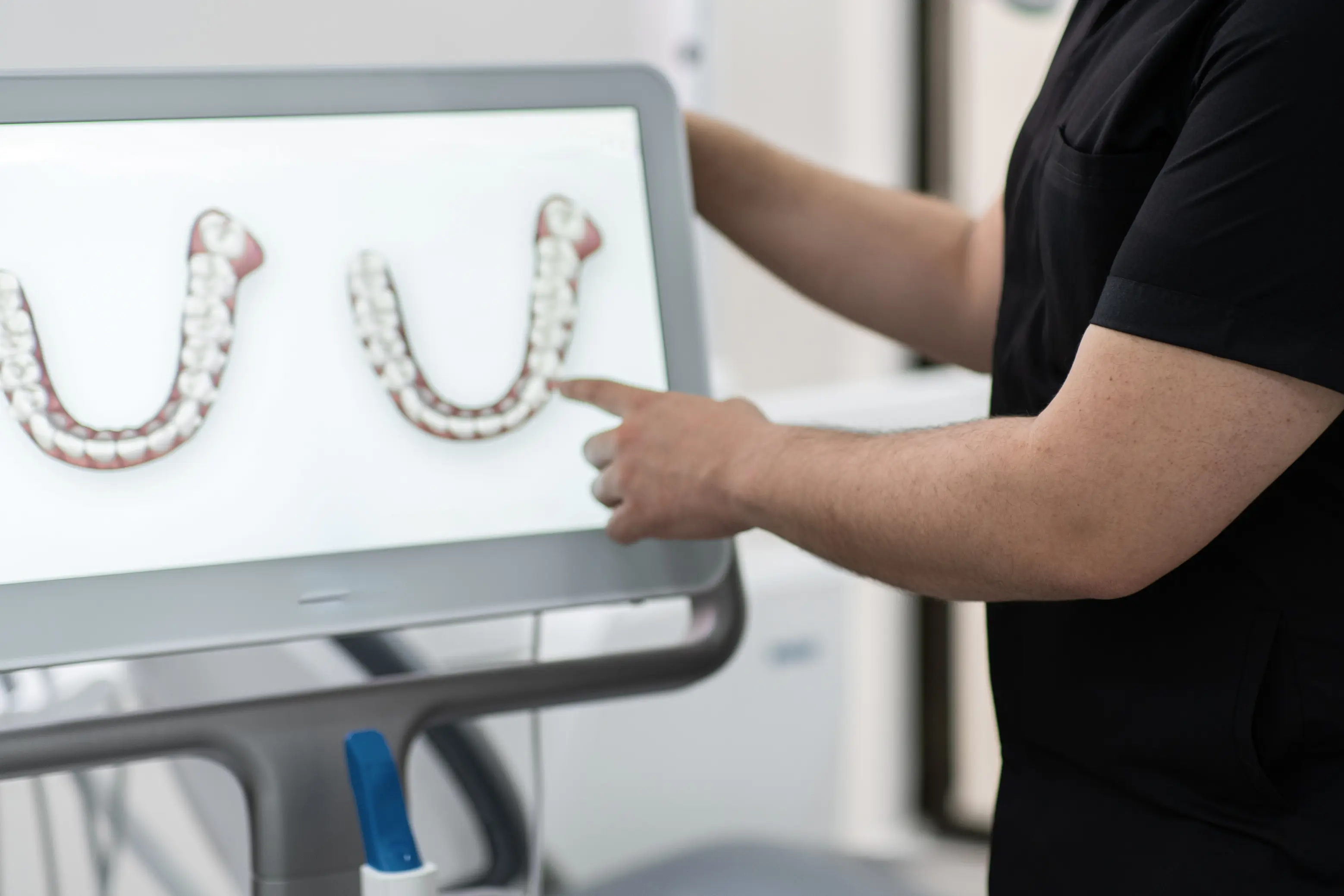 A clinician reviewing a 3D treatment simulation on a large monitor, displaying the planned positioning of multiple dental implants along the upper and lower arches for guided implant placement.