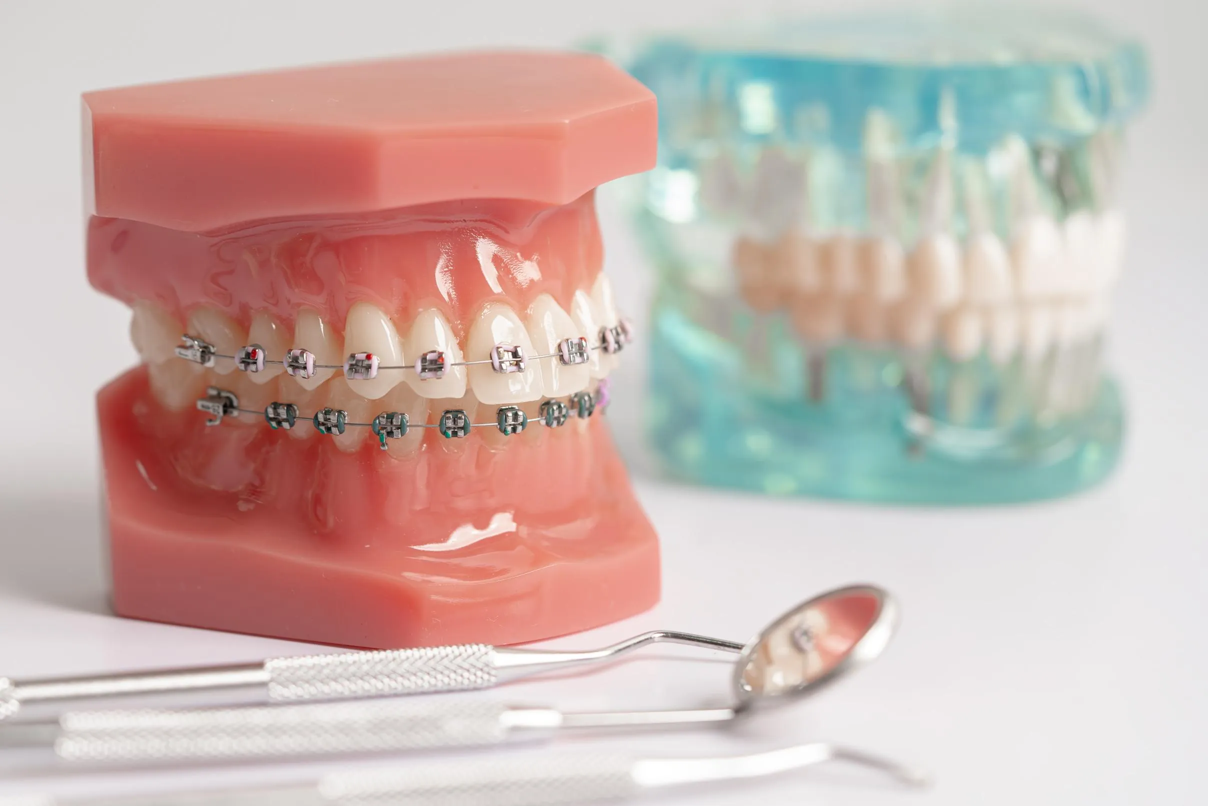 Two dental models side by side—one with metal braces and the other with clear braces displaying how traditional bracket-and-wire systems look on teeth, with dental tools placed in front for demonstration.