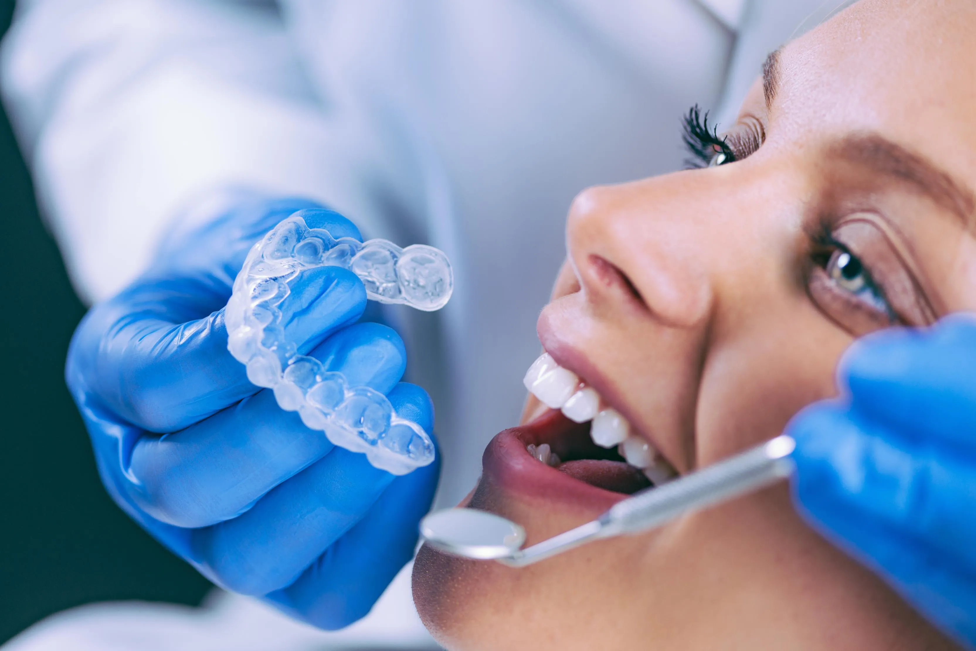 A dental professional wearing blue gloves places a clear aligner tray onto a smiling patient’s upper teeth while the patient reclines in the treatment chair, demonstrating how clear aligners fit snugly over the dental arch.