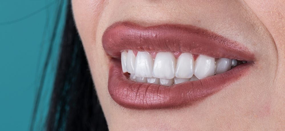 Close-up photo of woman's smile
