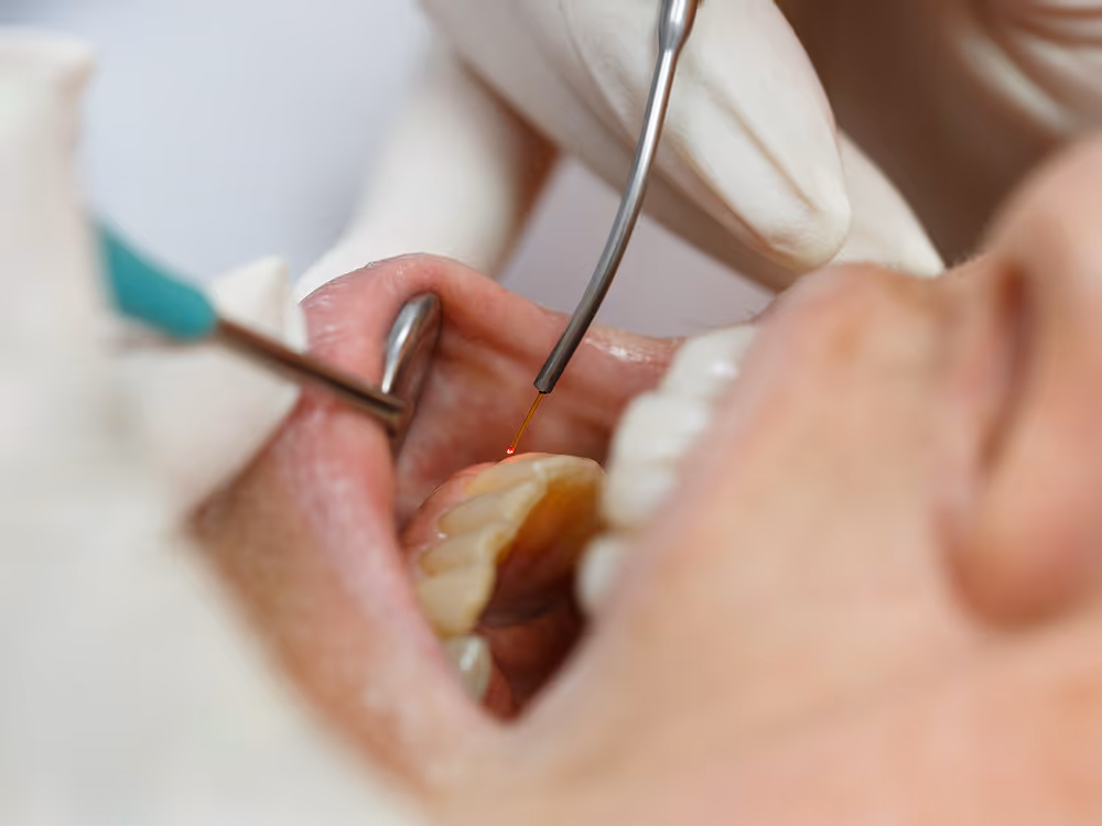 Azusa dental clinic uses Sapphire Laser technology