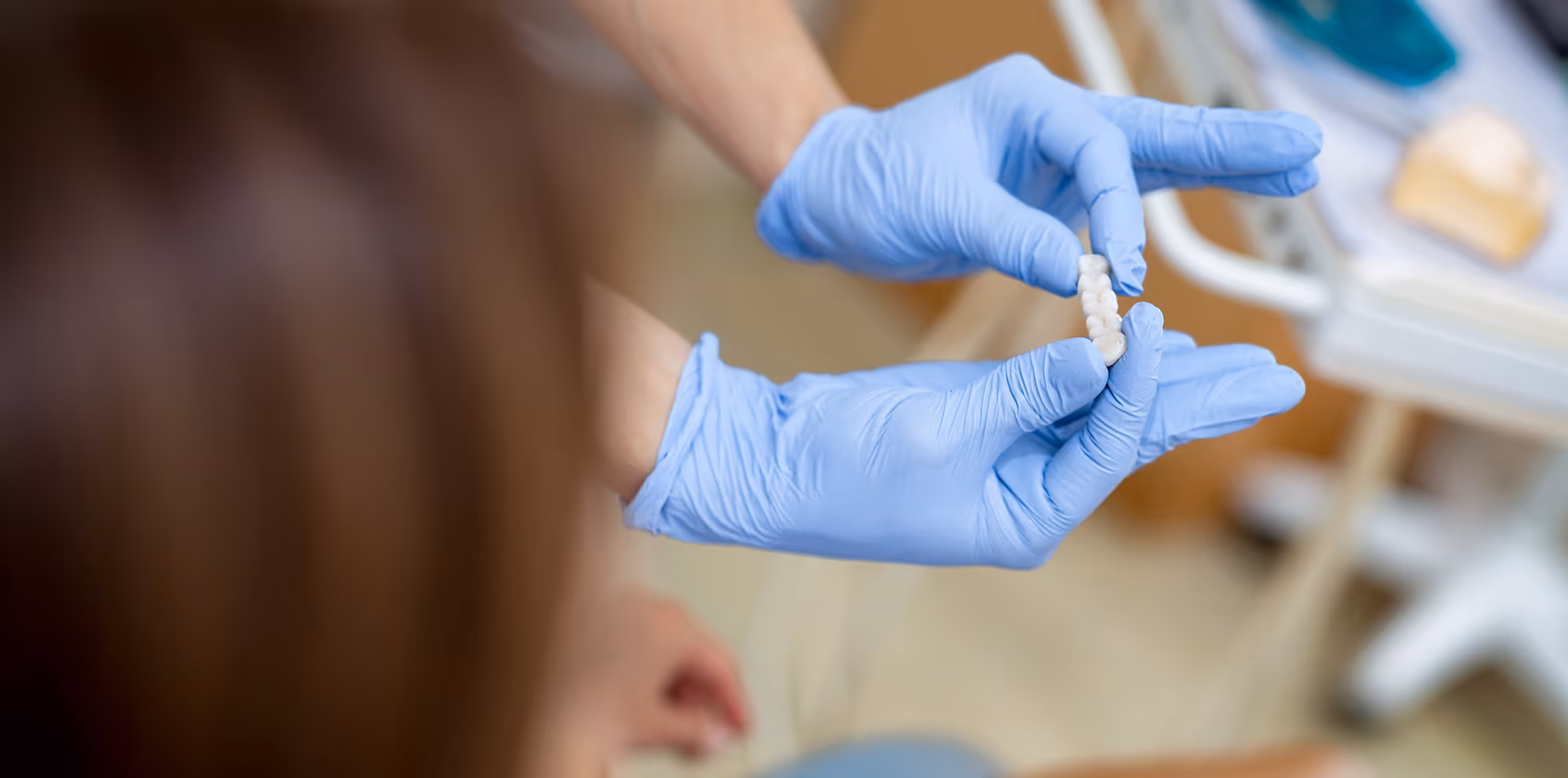 Dentist placing a porcelain crown to restore a damaged tooth using modern dental techniques