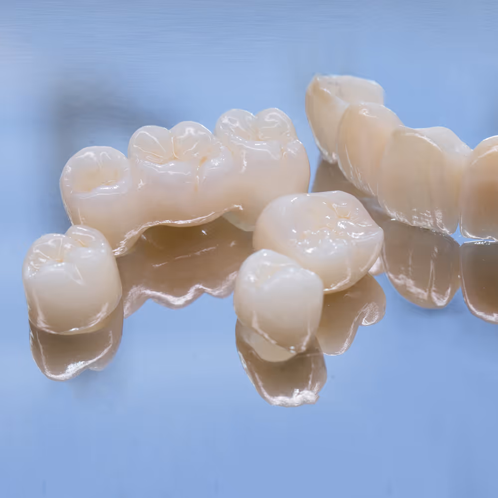 Illustration showing how porcelain crowns restore damaged teeth by covering and protecting them