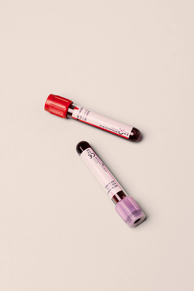 Tubes de prélèvement sanguin.