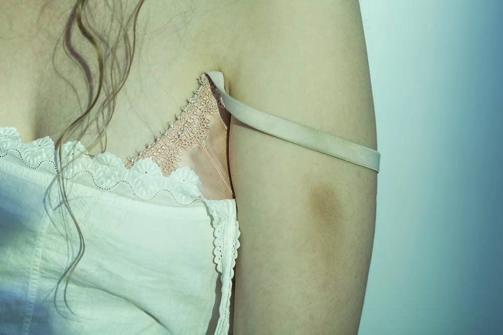 If Someone Assaults You In Massachusetts Can You Sue