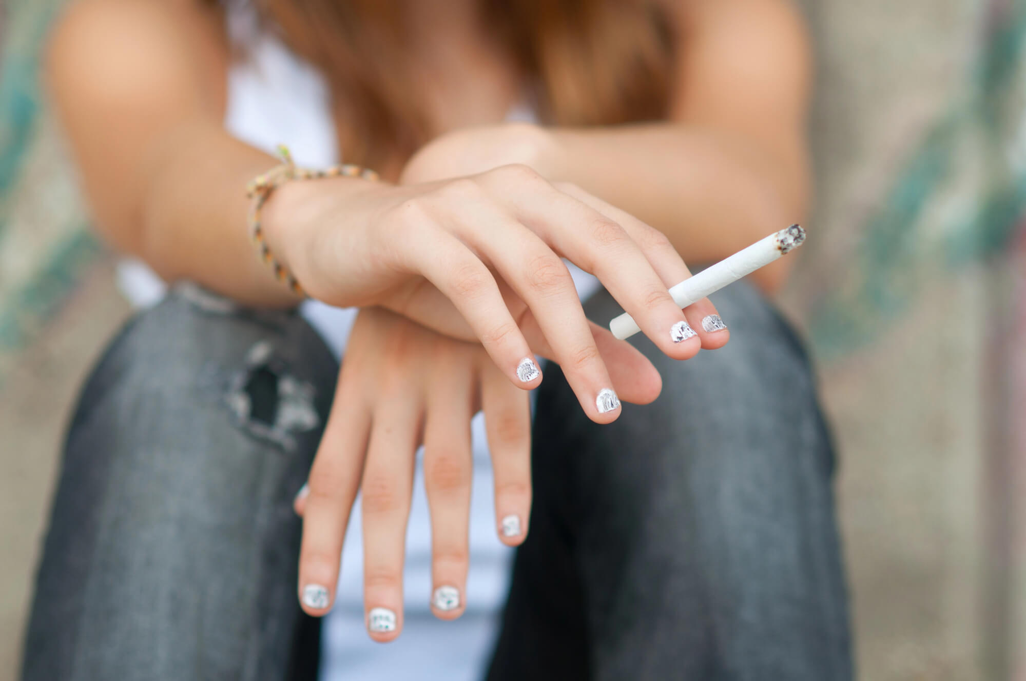 Stop Smoking Before a Teeth Bonding in Coral Gables