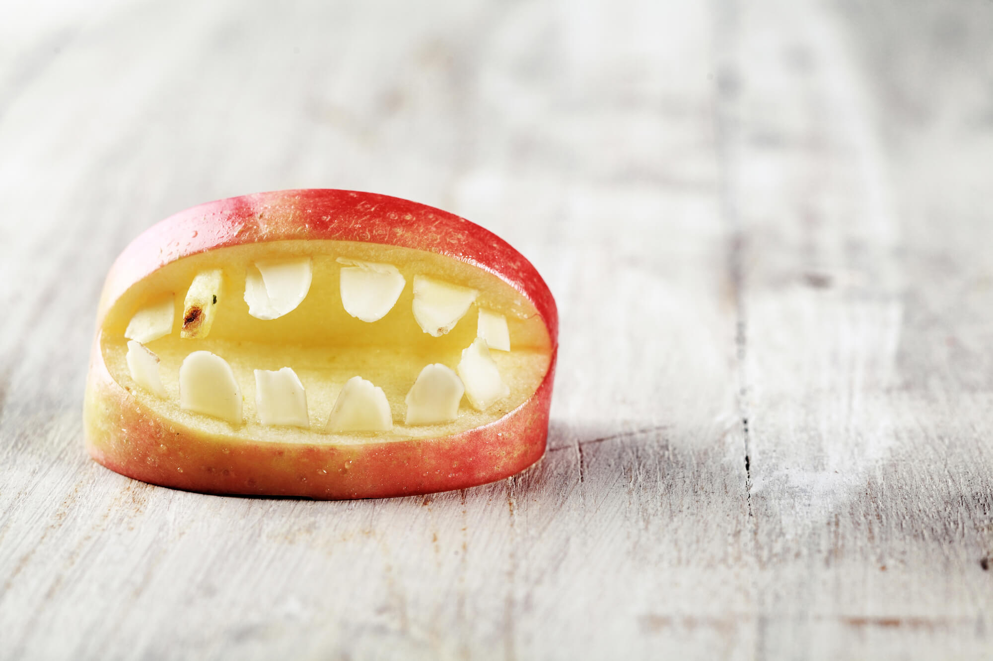 Coral Gables Dentist Explains Causes for Teeth Discoloration