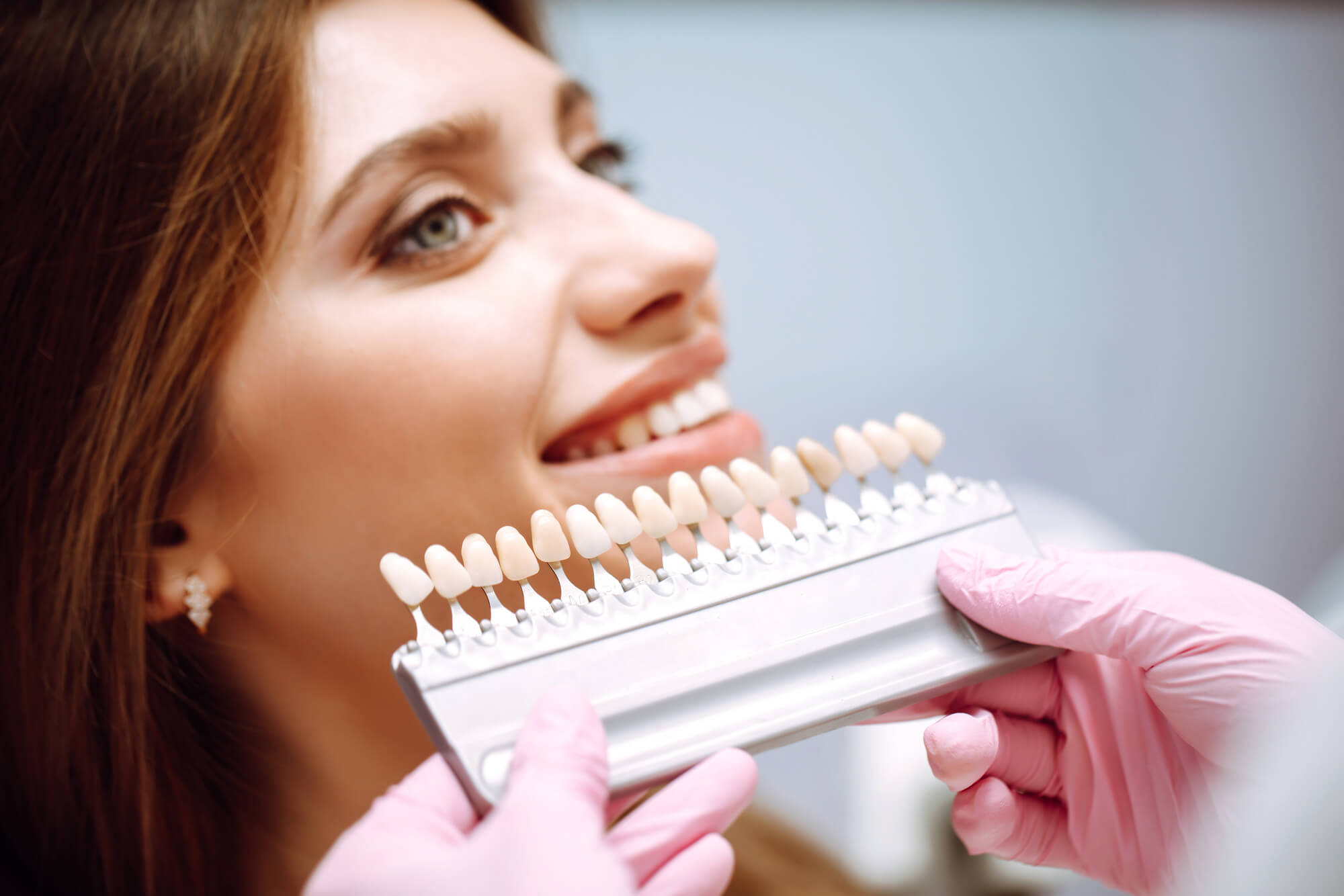 Considering Veneers with a Cosmetic Dentistry in Coral Gables