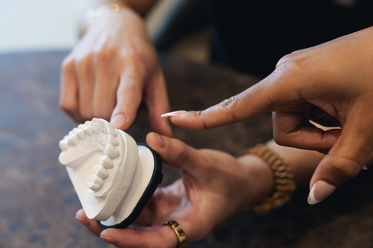 Two hands holding and pointing at a white dental mold of upper teeth on a table.
