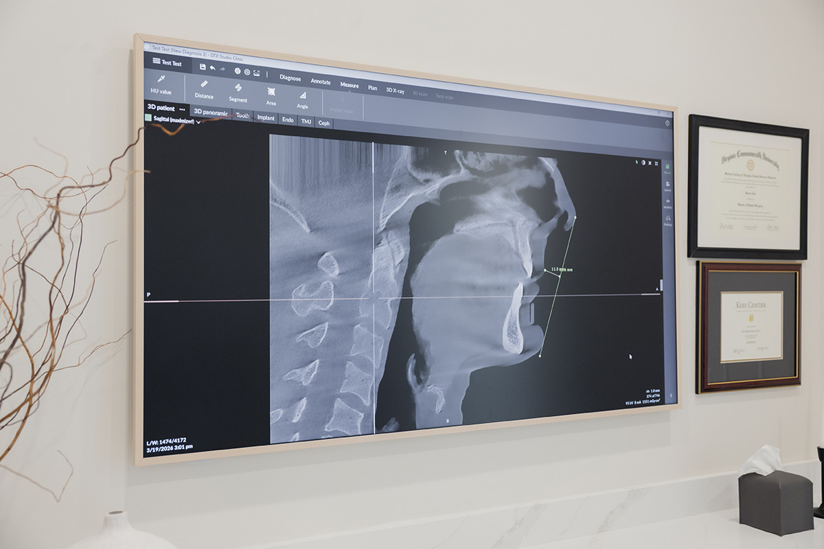 Monitor displays a digital side X-ray of a human head and neck with measurement lines visible.