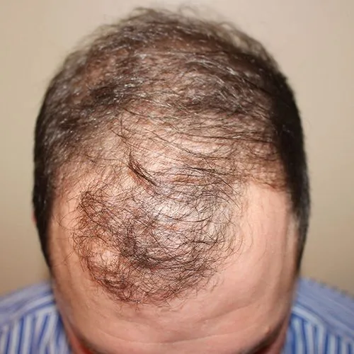 Before and after images